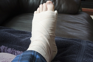 Bearing Weight on a Broken Foot