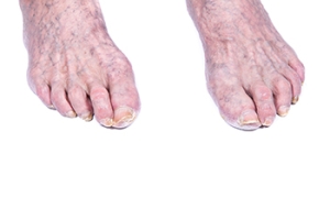 Essential Senior Foot Care Tips