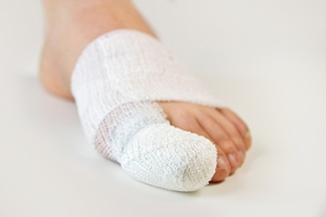 Exploring Big-Toe Joint Replacement Surgery